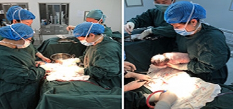 當高危產婦碰上“熊貓血”如何抉擇？