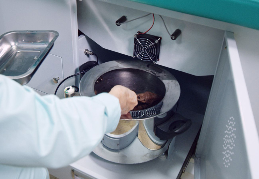 康復治療70天,偏癱患者步行出院!(圖2) 康復治療70天,偏癱患者步行出院!(圖2)