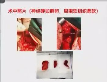 聚焦顯微外科|葫蘆島市醫(yī)學(xué)會(huì)顯微外科學(xué)分會(huì)第一屆第二次學(xué)術(shù)會(huì)議順利召開(kāi)(圖5) 聚焦顯微外科|葫蘆島市醫(yī)學(xué)會(huì)顯微外科學(xué)分會(huì)第一屆第二次學(xué)術(shù)會(huì)議順利召開(kāi)(圖5)