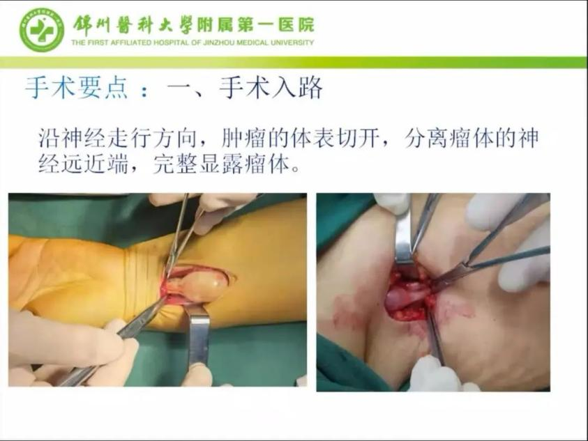 聚焦顯微外科|葫蘆島市醫(yī)學(xué)會(huì)顯微外科學(xué)分會(huì)第一屆第二次學(xué)術(shù)會(huì)議順利召開(kāi)(圖13) 聚焦顯微外科|葫蘆島市醫(yī)學(xué)會(huì)顯微外科學(xué)分會(huì)第一屆第二次學(xué)術(shù)會(huì)議順利召開(kāi)(圖13)