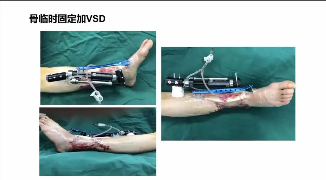 聚焦顯微外科|葫蘆島市醫(yī)學(xué)會(huì)顯微外科學(xué)分會(huì)第一屆第二次學(xué)術(shù)會(huì)議順利召開(kāi)(圖22) 聚焦顯微外科|葫蘆島市醫(yī)學(xué)會(huì)顯微外科學(xué)分會(huì)第一屆第二次學(xué)術(shù)會(huì)議順利召開(kāi)(圖22)